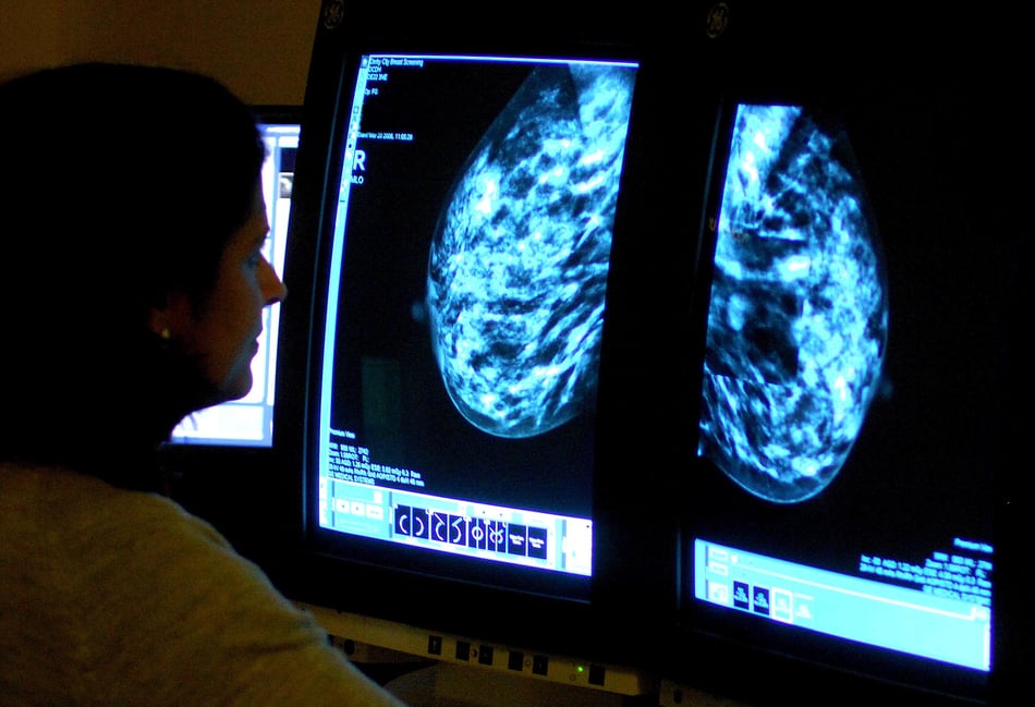 More women in Devon undergo breast cancer screening – as NHS England target met for first in five years